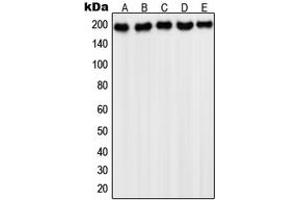 Western blot analysis of PDGFR alpha expression in HepG2 (A), NIH3T3 (B), Saos2 (C), HeLa (D), A431 (E) whole cell lysates. (PDGFRA antibody  (C-Term))