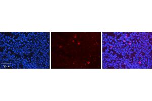Rabbit Anti-CRKL Antibody Catalog Number: ARP30524_P050 Formalin Fixed Paraffin Embedded Tissue: Human Lymph Node Tissue Observed Staining: Plasma membrane, Cytoplasm Primary Antibody Concentration: 1:100 Other Working Concentrations: 1:600 Secondary Antibody: Donkey anti-Rabbit-Cy3 Secondary Antibody Concentration: 1:200 Magnification: 20X Exposure Time: 0. (CrkL antibody  (Middle Region))