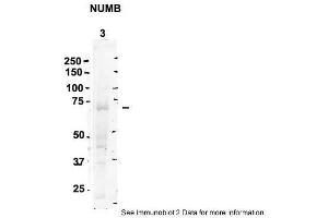 Sample Type: 3. (NUMB antibody  (C-Term))