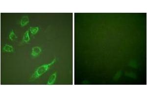 Immunofluorescence analysis of HeLa cells treated with PMA 125ng/ml 30', using 14-3-3 zeta (Phospho-Ser58) Antibody. (14-3-3 zeta antibody  (pSer58))