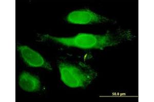 Image no. 3 for anti-Peroxiredoxin 2 (PRDX2) (AA 1-199) antibody (ABIN598967) (Peroxiredoxin 2 antibody  (AA 1-199))