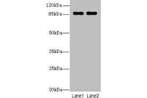 Western blot All lanes: VWA5A antibody at 1 μg/mL Lane 1: A549 whole cell lysate Lane 2: MCF-7 whole cell lysate Secondary Goat polyclonal to rabbit IgG at 1/10000 dilution Predicted band size: 87, 48, 46, 30 kDa Observed band size: 87 kDa (VWA5A antibody  (AA 1-415))