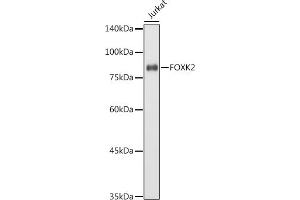 Western blot analysis of extracts of Jurkat cells, using FOXK2 antibody (ABIN7267238) at 1:1000 dilution. (Forkhead Box K2 antibody  (AA 511-660))