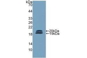 Detection of Recombinant FCN2, Mouse using Polyclonal Antibody to Ficolin 2 (FCN2) (Ficolin 2 antibody  (AA 97-254))