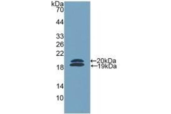 Ficolin 2 antibody  (AA 97-254)