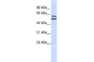 WB Suggested Anti-PIGQ Antibody Titration:  0. (PIGQ antibody  (N-Term))