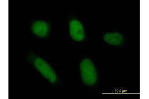 Immunofluorescence of purified MaxPab antibody to ANXA5 on HeLa cell. (Annexin V antibody  (AA 1-320))