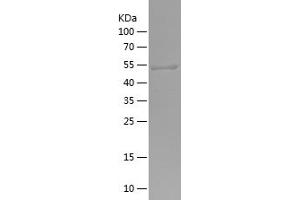 Western Blotting (WB) image for Exocyst Complex Component 7 (EXOC7) (AA 65-270) protein (His-IF2DI Tag) (ABIN7122860) (EXOC7 Protein (AA 65-270) (His-IF2DI Tag))