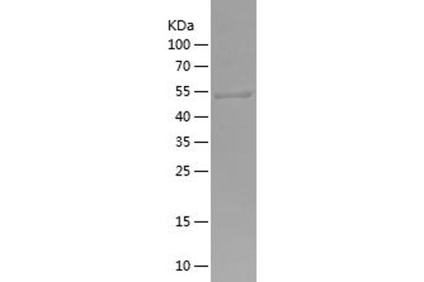 EXOC7 Protein (AA 65-270) (His-IF2DI Tag)