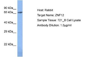 Host: Rabbit Target Name: ZNF12 Sample Type: 721_B Whole Cell lysates Antibody Dilution: 1. (ZNF12 antibody  (N-Term))