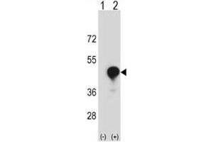 Western blot analysis of CD1c antibody and 293 cell lysate (2 ug/lane) either nontransfected (Lane 1) or transiently transfected (2) with the CD1C gene. (CD1c antibody  (AA 226-253))