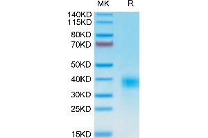 CD94 Protein (AA 34-179) (His-Avi Tag)