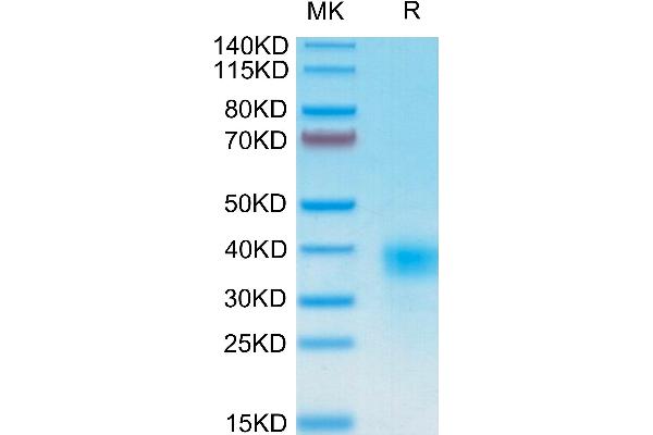 CD94 Protein (AA 34-179) (His-Avi Tag)