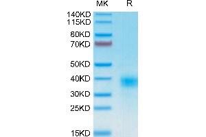 Human CD94 on Tris-Bis PAGE under reduced condition. (CD94 Protein (AA 34-179) (His-Avi Tag))