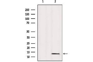Western blot analysis of extracts from Mouse heart, using L36mt Antibody. (MRPL36 antibody  (Internal Region))