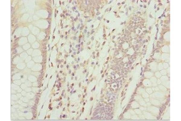 ZFAND3 antibody  (AA 1-227)