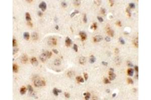 Immunohistochemical staining of mouse brain cells with AP3M1 polyclonal antibody  at 5 ug/mL. (AP3M1 antibody  (C-Term))