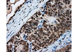 Immunohistochemical staining of paraffin-embedded Kidney tissue using anti-LTA4H mouse monoclonal antibody. (LTA4H antibody)