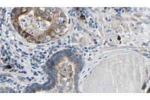 ABIN6279398 at 1/100 staining Human prostate tissue by IHC-P. (RNF41 antibody  (Internal Region))