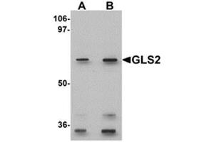 Western blot analysis of GLS2 in rat kidney tissue lysate with GLS2 antibody at (A) 0. (GLS2 antibody  (Center))