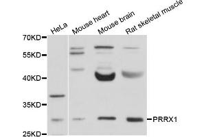 Western blot analysis of extracts of various cell lines, using PRRX1 antibody (ABIN4904876) at 1:1000 dilution. (PRRX1 antibody)