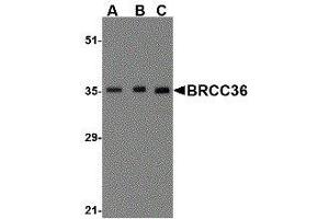 Western Blotting (WB) image for anti-BRCA1/BRCA2-Containing Complex, Subunit 3 (BRCC3) (N-Term) antibody (ABIN2477712) (BRCC3 antibody  (N-Term))