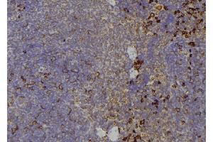 ABIN6267197 at 1/100 staining Human lymph node tissue by IHC-P. (TEK antibody  (pTyr992))