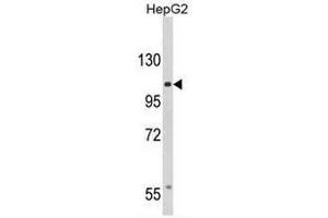 Western blot analysis of CACNA2D3 Antibody (C-term) in HepG2 cell line lysates (35µg/lane).