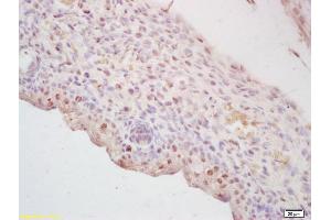 Immunohistochemistry (IHC) image for anti-Core-Binding Factor, beta Subunit (CBFB) (AA 85-182) antibody (ABIN1387433)