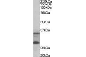 Image no. 1 for anti-U6 SnRNA Biogenesis 1 (USB1) (AA 154-167) antibody (ABIN1100335) (C16orf57 antibody  (AA 154-167))