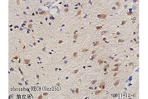 Formalin-fixed and paraffin embedded rat brain tissue labeled with Anti phospho-REC8(Ser251) Polyclonal Antibody, Unconjugated (ABIN872285) followed by conjugation to the secondary antibody and DAB staining