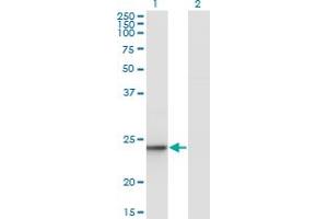 Ube2t antibody  (AA 1-197)