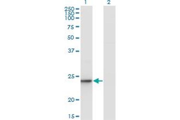 Ube2t anticorps  (AA 1-197)