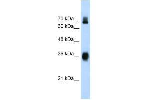 Western Blot showing KEAP1 antibody used at a concentration of 1-2 ug/ml to detect its target protein. (KEAP1 antibody  (C-Term))