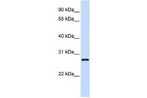 Western Blotting (WB) image for anti-TGFB-Induced Factor Homeobox 2-Like, X-Linked (TGIF2LX) antibody (ABIN2458211) (TGIF2LX antibody)