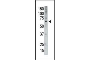 The anti-GED2 C-term Antibody (ABIN390118 and ABIN2840626) is used in Western blot to detect GED2 in A549 lysate. (MAGED2 antibody  (C-Term))