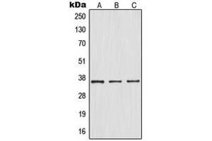 Western blot analysis of IKB alpha (pS32/S36) expression in HepG2 TNFa-treated (A), Raw264. (NFKBIA antibody  (N-Term, pSer32, pSer36))