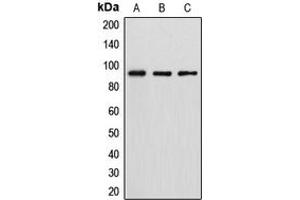 Western blot analysis of DGK beta expression in HT29 (A), MCF7 (B), HeLa (C) whole cell lysates. (DGKB antibody  (C-Term))
