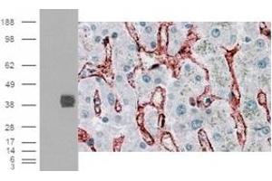 Immunohistochemistry (IHC) image for anti-Fc gamma RII (CD32) (C-Term) antibody (ABIN2465516) (Fc gamma RII (CD32) (C-Term) antibody)