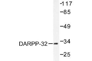 Image no. 1 for anti-Protein Phosphatase 1, Regulatory (Inhibitor) Subunit 1B (PPP1R1B) antibody (ABIN271882) (DARPP32 antibody)