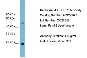 WB Suggested Anti-HDGFRP3  Antibody Titration: 0.