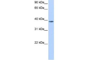 WB Suggested Anti-NUDT13 Antibody Titration:  0. (NUDT13 antibody  (N-Term))