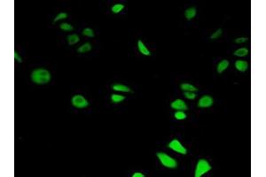 IHC-P analysis of Human HeLa cells, with FITC staining. (HIF1AN antibody  (AA 2-349))