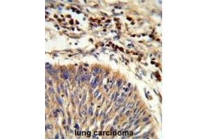 Immunohistochemistry (IHC) image for anti-Heat Shock 70kDa Protein 6 (HSP70B') (HSPA6) antibody (ABIN3003879) (HSPA6 antibody)