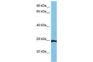 Host:  Mouse  Target Name:  GTF2F2  Sample Tissue:  Mouse Small Intestine  Antibody Dilution:  1ug/ml (GTF2F2 antibody  (Middle Region))