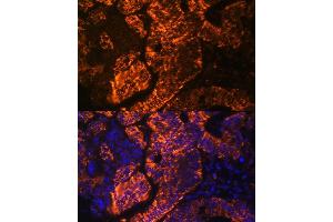 Immunofluorescence analysis of human colon carcinoma cells using TNFRSF25 antibody (ABIN7271071) at dilution of 1:100. (DR3/LARD antibody  (AA 240-426))