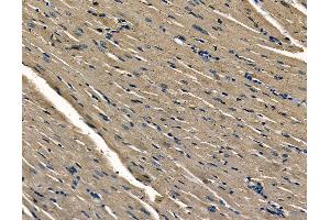 ABIN6263014 and ABIN6278668 at 1/100 staining rat heart tissue by IHC-P. (LSM1 antibody  (N-Term))