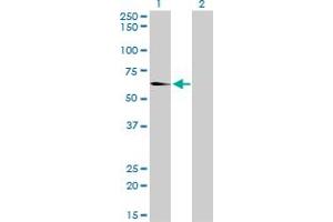 Western Blot analysis of EHD2 expression in transfected 293T cell line by EHD2 monoclonal antibody (M01), clone 2D8. (EHD2 antibody  (AA 365-427))
