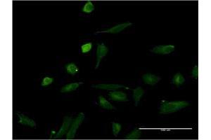 Immunofluorescence (IF) image for anti-Interleukin 1 alpha (IL1A) (AA 172-271) antibody (ABIN516992)