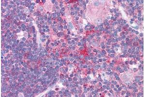 Human Thymus (formalin-fixed, paraffin-embedded) stained with HDAC6 antibody ABIN214772 at 5 ug/ml followed by biotinylated goat anti-rabbit IgG secondary antibody ABIN481713, alkaline phosphatase-streptavidin and chromogen. (HDAC6 antibody  (AA 69-118))